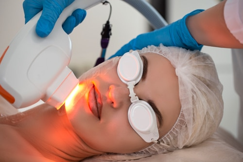 Ultherapy treatment as part of the nonsurgical neck lift