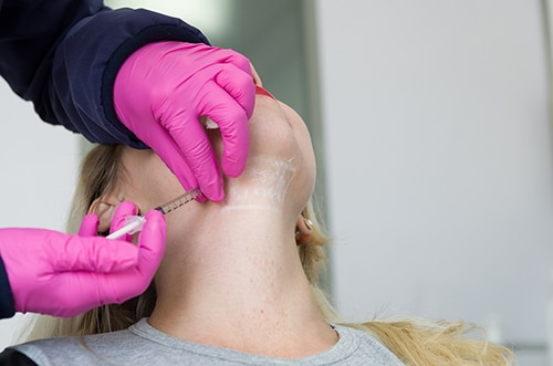 Kybella injection under chin